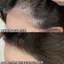 Hair Contouring Shadow Powder Retouching Forehead Hairline Thay thế vẻ đẹp Người mới biết Mỹ phẩm thân thiện 6.23 9CW0