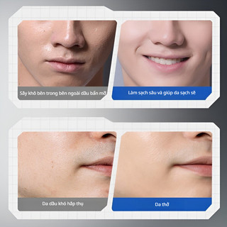 Sữa Rửa Mặt Nam 5% Niacinamide Kiềm Dầu Sạch Mụn Se Khít Lỗ Chân Lông Trắng Sáng Da Bọt Mịn Khô Ráo 12h Chính Hãng 100ml