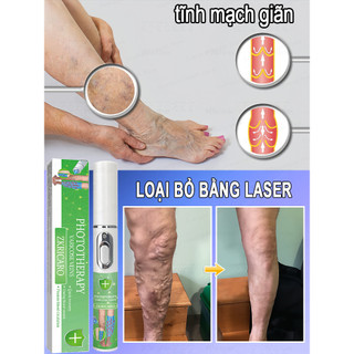 [Nhập khẩu từ Hàn Quốc] Loại bỏ tĩnh mạch Laser có thể giảm đau, giúp giảm giãn tĩnh mạch, ngăn ngừa giãn tĩnh mạch và làm dịu chân