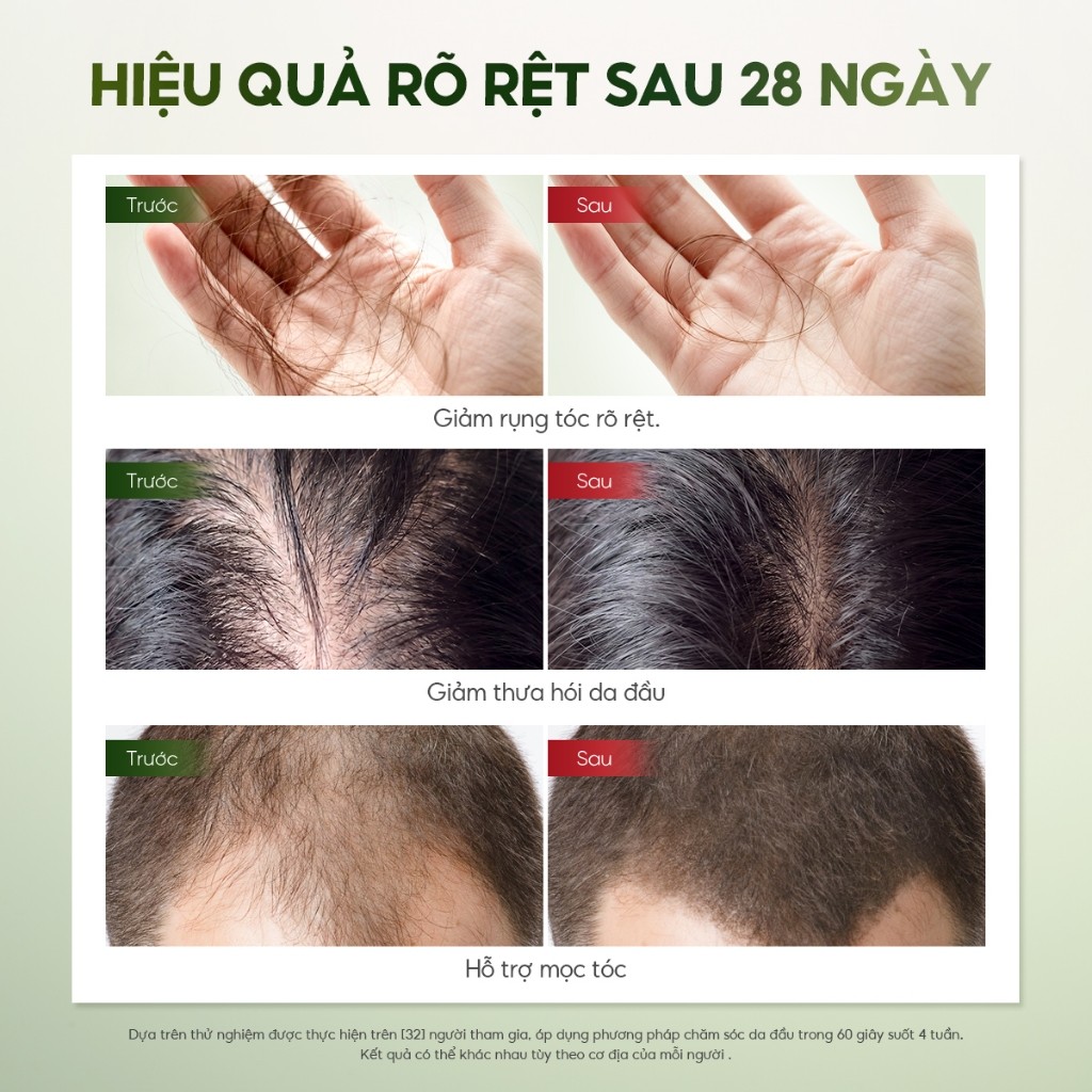 Xịt mọc tóc Lab on Hair 160ml xịt dưỡng tóc với giấm táo Kích thích mọc tóc Rụng Tóc