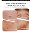 Miếng Dán Mụn Hydrocolloid Hình Ngôi Sao Màu Tàng Hình Hút Mủ Gom Cồi Kháng Khuẩn Thoáng Khí Dễ Trang Điểm Chống Nước Cao Cấp
