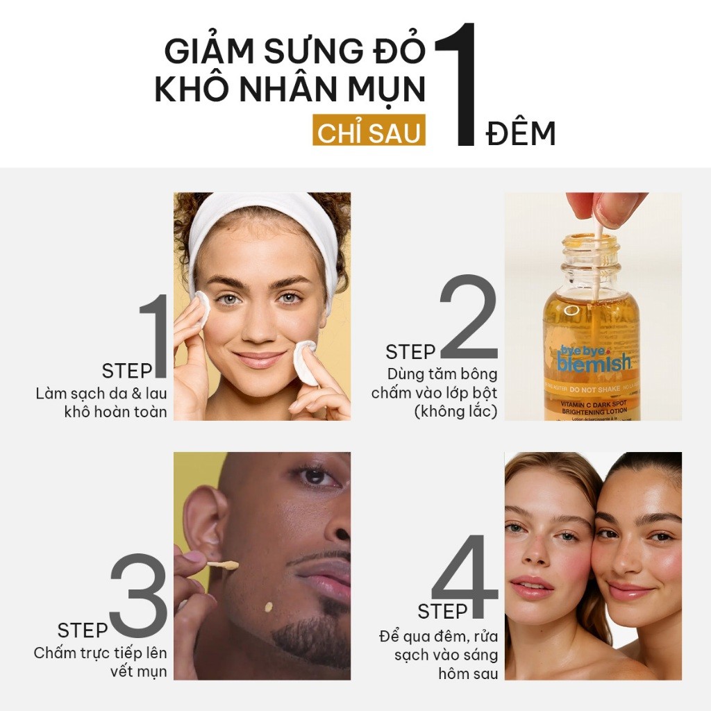 Chấm Thâm Mụn Vitamin C Giảm Thâm Mụn Nhanh Bye Bye Blemish Vitamin C Dark Spot Brightening Lotion 30ml
