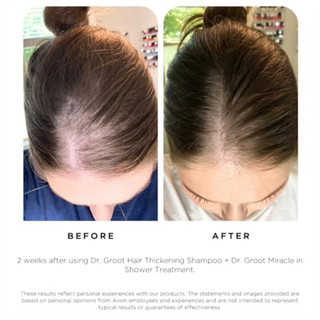 Dr. Groot Intensive Care Multi-Perfection Hair Loss Control Shampoo
