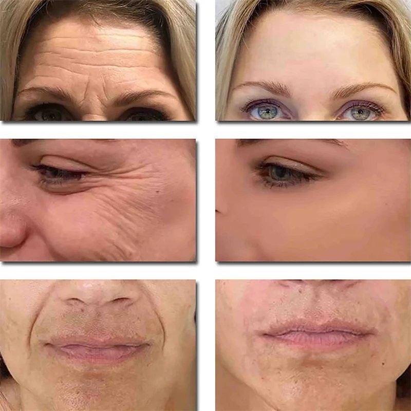 Bán SEOUL 1988 Vitamin C Chăm Sóc Nhăn 4% Retinol Tinh Chất Nhân Sâm Kem Dưỡng Ẩm Mắt