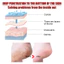Mặt nạ tẩy tế bào chết Jaysuing 5 đôi AHA 30% + BHA 2% Mặt nạ lột chân Loại bỏ chết Da nứt nẻ Dưỡng ẩm Tất điều trị bàn chân mịn màng