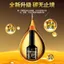 Người Phục Vụ Du Lịch Ba Nam Tư Chất Xúc Tác Bụi Động Cơ Bên Trong Loại Bỏ Carbon Tiền Gửi Miễn Phí Tháo Rời Kim Phun Nhiên Liệu Bảo Trì Tăng Cường Điện 6.15