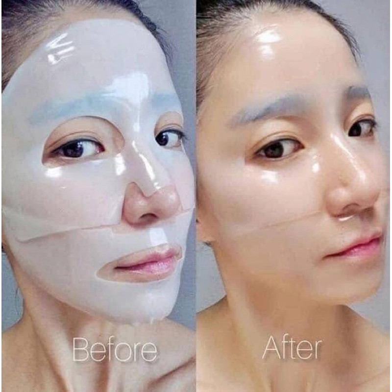 [HÀNG CÔNG TY] Mặt Nạ Thạch Vàng MediAnswer Vita Collagen Mask 35g Hộp 5 Miếng Chống Lão Hóa Dưỡng Trắng
