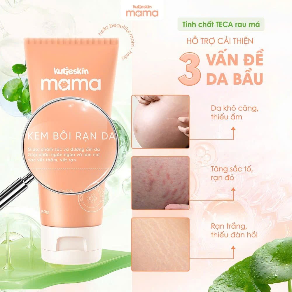 Kem Rạn Da Mờ Cả Rạn Đỏ Rạn Trắng Kutieskin Mama, Giảm Kích Thước Vết Rạn, Mờ Vết Rạn Lâu Năm
