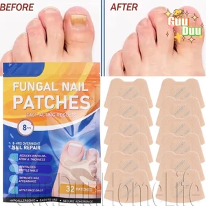 Miếng dán chỉnh sửa chăm sóc móng chân - Thoáng khí, tự dính - Miếng dán chỉnh sửa ngón chân có thể điều chỉnh - Miếng dán sửa móng tay dày - Máy duỗi dùng một lần / Giao hàng miễn phí