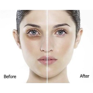 [Chỉ Bán Hàng Thái]Kem giảm thâm, bọng, nhăn vùng mắt Thái Lan 5ML