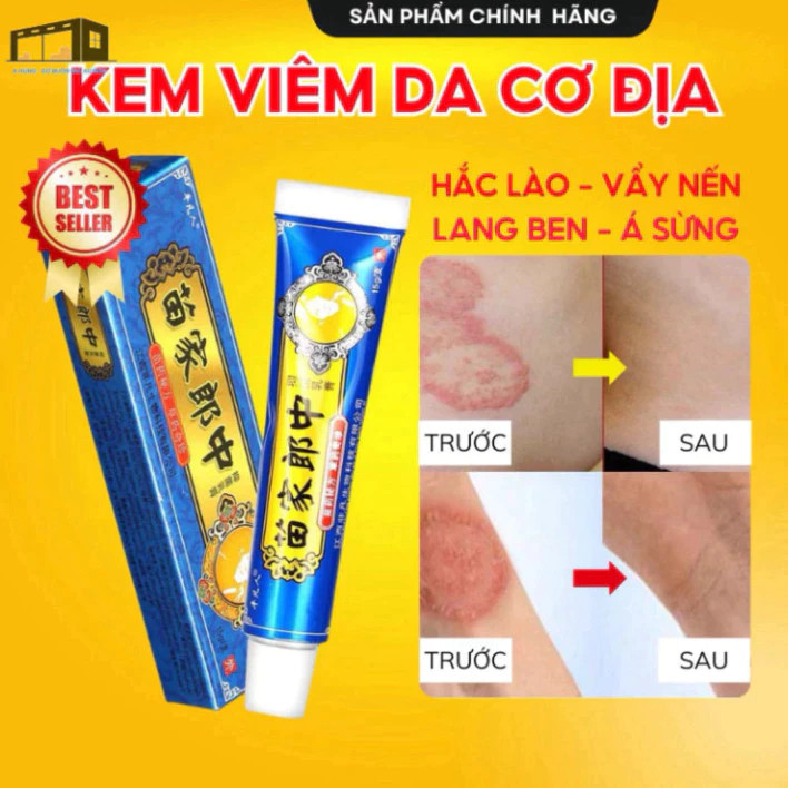 thuốc bôi nấm ngứa,  vẩy nến, á sừng lang ben, viêm da cơ địa,hắc lào - thảo dược tự nhiên[kem xanh]