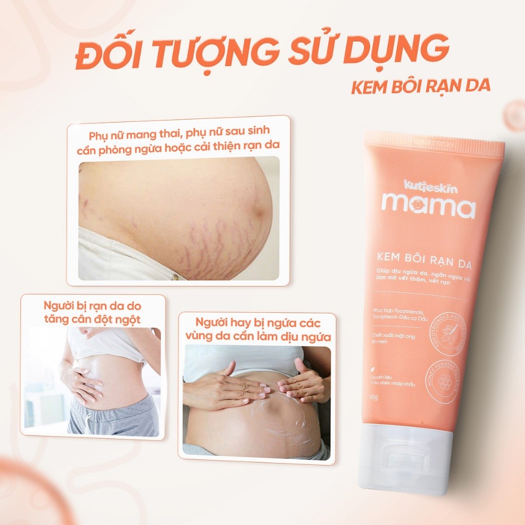 Kem Rạn Da Mờ Cả Rạn Đỏ Rạn Trắng Kutieskin Mama, Giảm Kích Thước Vết Rạn, Mờ Vết Rạn Lâu Năm