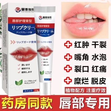Viêm Môi Chuyên Dụng Son Môi Thuốc Khô Nứt Miệng Lột Đỏ Sưng Ngứa Buster Lột Dài Vỉ Keratinis Fire Y