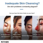 Thiết bị tạo bong bóng điện 3 chế độ Máy hút bụi lỗ chân lông loại bỏ mụn đầu đen, Đèn xanh có thể sạc lại USB — ảnh 8