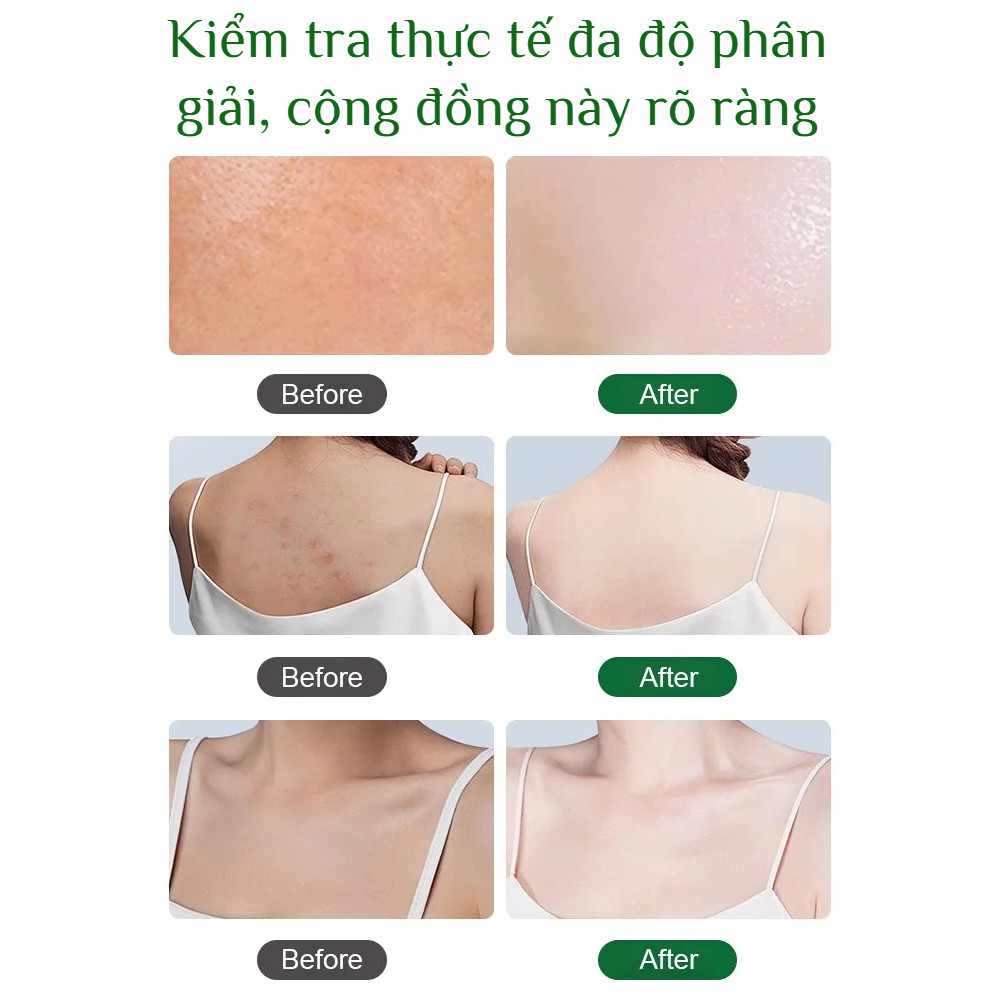 ✨Mua 1 tặng 1✨Tẩy tế bào chết toàn thân làm sạch sâu/sữa rửa mặt/gel tẩy tế bào chết toàn thân kiểm soát dầu