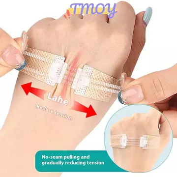 TMOY Dây Kéo Dây Buộc Vết Thương Miếng Dán Tĩnh Điện Miếng Dán Vết Thương Nhanh Không Có Vết Thương Dây Kéo Ngoài Trời Ban Nhạc-Aid Di Động Qui Chép Vết Thương TMOY