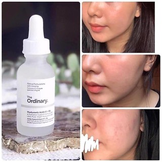 Tinh chất sáng da The ordinary Niacinamide 10% + Zinc 1% (30 ml) giảm dầu, giảm mụn, mờ thâm sau mụn