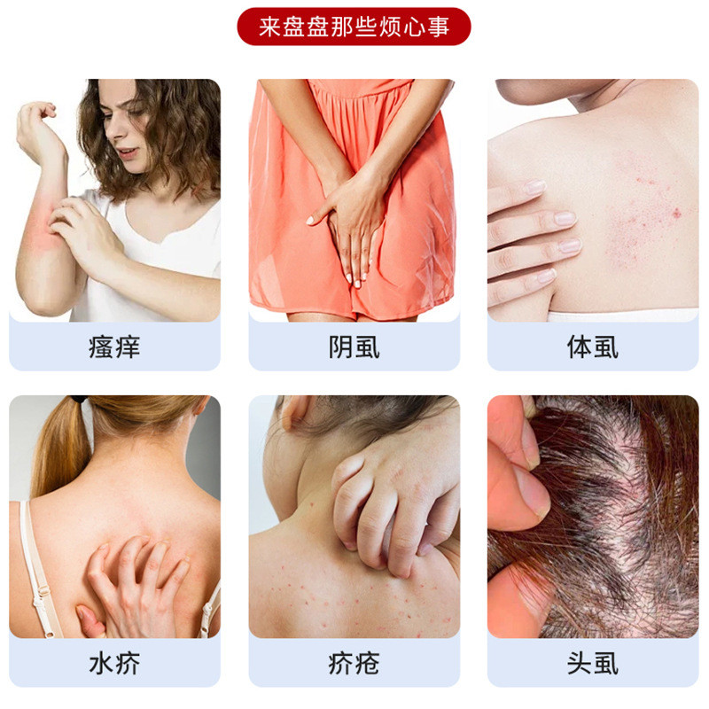 [Khuyến nghị của cửa hàng] Thái Lan Bangba Lice One Spray Làm dịu da Ngứa cơ thể Chấy rận Infidel Chất lỏng khó chịu 10.22