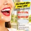🔥sốc🔥Răng giả Smile cài khớp thẩm mỹ | Hàm giả chỉnh nha che khuyết điểm răng xấu | Hàm giả chống nhô tiện lợi