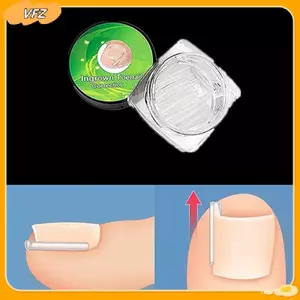 VFZ 50 Cái Dụng cụ chỉnh sửa móng chân mọc ngược Ngón chân Điều trị móng tay Miếng dán đàn hồi Stier Kẹp thẳng Nẹp Dụng cụ làm móng chân Louislifecool