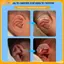 VFZ Protruding Ear Hỗ Trợ Trẻ Sơ Sinh Corrector Dụng Cụ Silicon Auricle Chỉnh Miếng Dán Cho Bé Tai Corrector Bé Auraille Valgus Correction Louislifecool