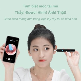 Dụng Cụ Lấy Ráy Tai Không Dây, Kết Nối App Trên Điện Thoại, Hình Ảnh Sắc Nét, Đầu Silicone An Toàn, Pin Trâu Dùng Lâu