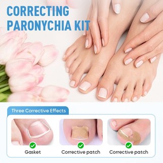 Bộ chỉnh sửa móng chân mọc ngược chuyên nghiệp với miếng dán chỉnh sửa móng tay mọc ngược thoáng khí dải chỉnh sửa móng chân cong dụng cụ làm móng chân không đau và dụng cụ nâng chân cho nữ 1 Bộ