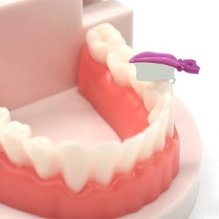 Bộ 50 Nha Khoa Prime Răng Nhựa Liên Cấp Nêm Bảo Vệ Với Ma Trận Thép Bảo Vệ Kim Loại
