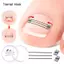 Khung Ảnh Cây Phát Triển Móng Chân Corrector Kẹp Dụng Cụ Nẹp Móng Chân Phục Hồi Nhúng Ngón Chân Điều Trị Móng Tay Chuyên Nghiệp Phát Triển Móng Chân Thẳng VN