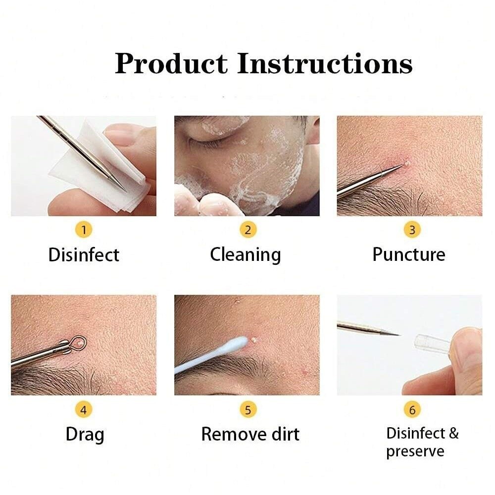 FAVORITEGOODS 4 / 6 cái / bộ Bộ kim mụn đầu đen, Công cụ vắt mụn đầu đen chăm sóc da mặt Sliver, Dụng cụ chuyên nghiệp Dụng cụ làm sạch lỗ chân lông vàng hồng bằng thép không gỉ Điều trị làm đẹp