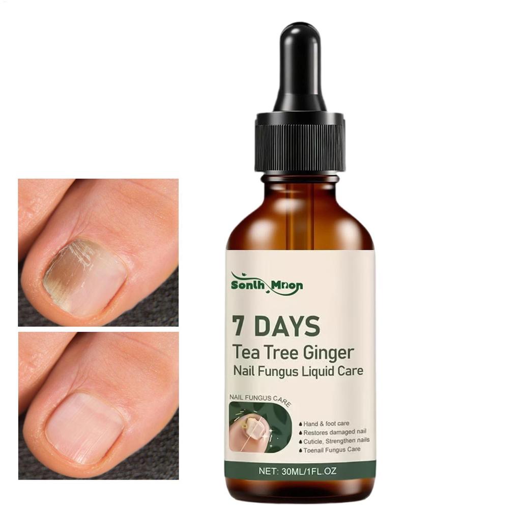 Dung dịch chăm sóc móng tay 30ml Dung dịch chăm sóc móng chân nhẹ nhàng Chất lỏng sửa chữa móng chân cho chuyến đi công tác tại nhà Salon trong nhà ewoekvn