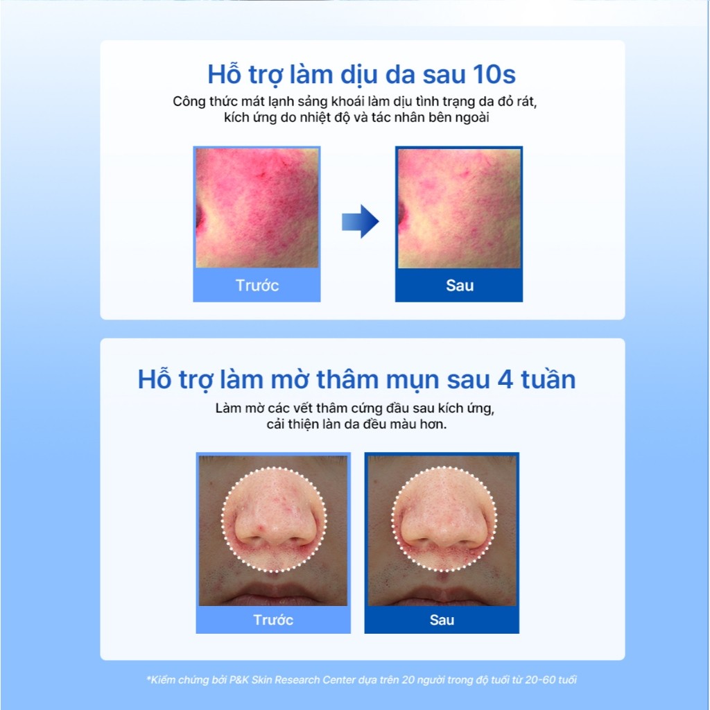 [DATE T6-T11/27] Kem dưỡng ẩm Dear, Klairs Midnight Blue Clearing Water Cream hỗ trợ tái tạo da 50g [FS]
