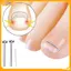VFZ Dụng cụ chỉnh sửa móng chân mọc ngược Phục hồi móng chân Nhúng ngón chân Điều trị móng chân mọc ngược chuyên nghiệp Dụng cụ chăm sóc bàn chân Louislifecool