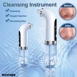 Thiết bị tạo bong bóng điện 3 chế độ Máy hút bụi lỗ chân lông loại bỏ mụn đầu đen, Đèn xanh có thể sạc lại USB — ảnh 2