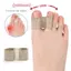 1 Dụng cụ chăm sóc bàn chân Dụng cụ tách ngón chân bằng silicon Bunion Hallux Valgus Corrector Máy duỗi ngón tay cái