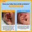 VFZ Protruding Ear Hỗ Trợ Trẻ Sơ Sinh Corrector Dụng Cụ Silicon Auricle Chỉnh Miếng Dán Cho Bé Tai Corrector Bé Auraille Valgus Correction Louislifecool
