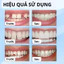 Nhựa Nhiệt Tạo Răng Giả Tạm 30g - Dễ Định Hình, Phù Hợp Mọi Lứa Tuổi