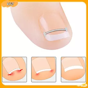 Dụng cụ chỉnh sửa móng chân mọc ngược VFZ chuyên nghiệp, phục hồi móng, kẹp điều trị móng chân Louislifecool