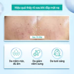 Combo 3 Hộp Mặt Nạ Sợi Xơ Rau Má Centella Fiber KEYSHU Dưỡng Ẩm, Làm Mềm Da (30ml x 30 miếng) — ảnh 8