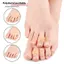 1 Cặp Dụng cụ tách ngón chân có thể tái sử dụng Dụng cụ chỉnh sửa ngón chân Bunion Bảo vệ ngón chân nhỏ Hallux Valgus Miếng đệm giảm đau chăm sóc bàn chân Chăm sóc bàn chân