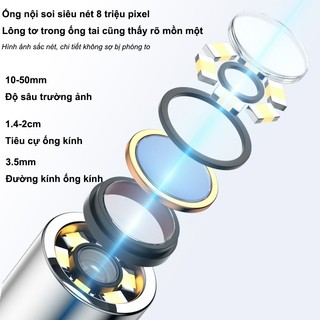 Dụng Cụ Lấy Ráy Tai Không Dây, Kết Nối App Trên Điện Thoại, Hình Ảnh Sắc Nét, Đầu Silicone An Toàn, Pin Trâu Dùng Lâu