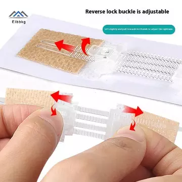 ELBBKG Dây Kéo Dây Buộc Vết Thương Đóng Miếng Dán Huyết Định Miếng Dán Vết Thương Nhanh Không Cần Khâu Dây Kéo Ngoài Trời Ban Nhạc-Aid Di Động Qui Clot Vết Thương Mới
