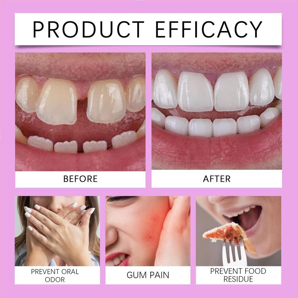 Keo Dán Răng Giả Kem Dính Nhẹ Nhàng Ổn Định Nguyên Bản Dán An Toàn Chăm Sóc Tạm Thời Cho Nữ Du Lịch Tại Nhà ewoekvn