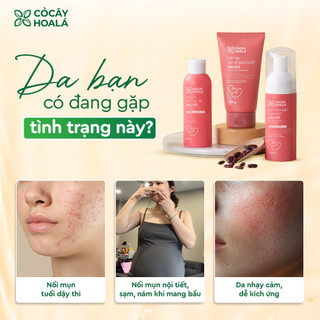 Combo Chăm Sóc Da Đậu Đỏ 150g | Làm Sạch Sâu, Dưỡng Ẩm, Sáng Da | Tặng Minisize | Nhà Mộc Nhiên