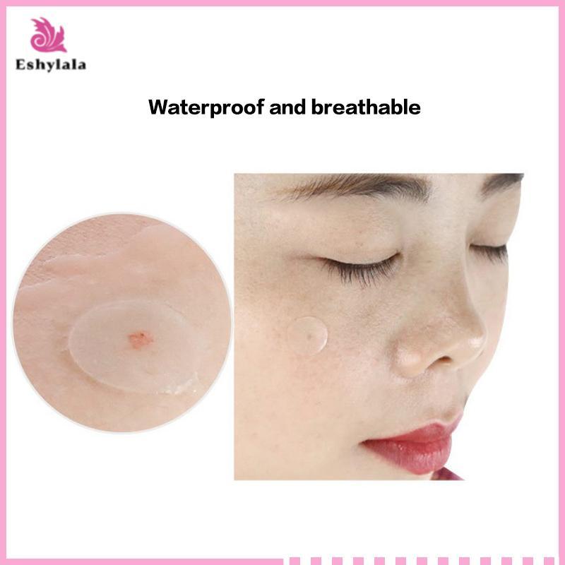 Eshylala 24 / 36 Miếng Dán Miếng Dán Mụn Hydrocolloid Miếng Dán Hình Dạng Chống Thấm Nước Màu Trắng Tròn Điểm Điều Trị Mụn Miếng Dán Che Khuyết Điểm [MỚI]