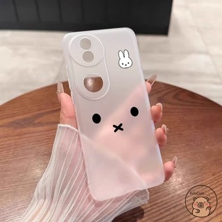 Dành Cho Samsung Galaxy A56 A55 A54 A53 A17 A16 M55 C55 S20 S10 Note 20 Ultra FE S10e 10 Plus S20 + S10 + 10 + 9 Ốp Điện Thoại Thỏ Trắng Dễ Thương Vỏ Trong Suốt Hoạt Hình