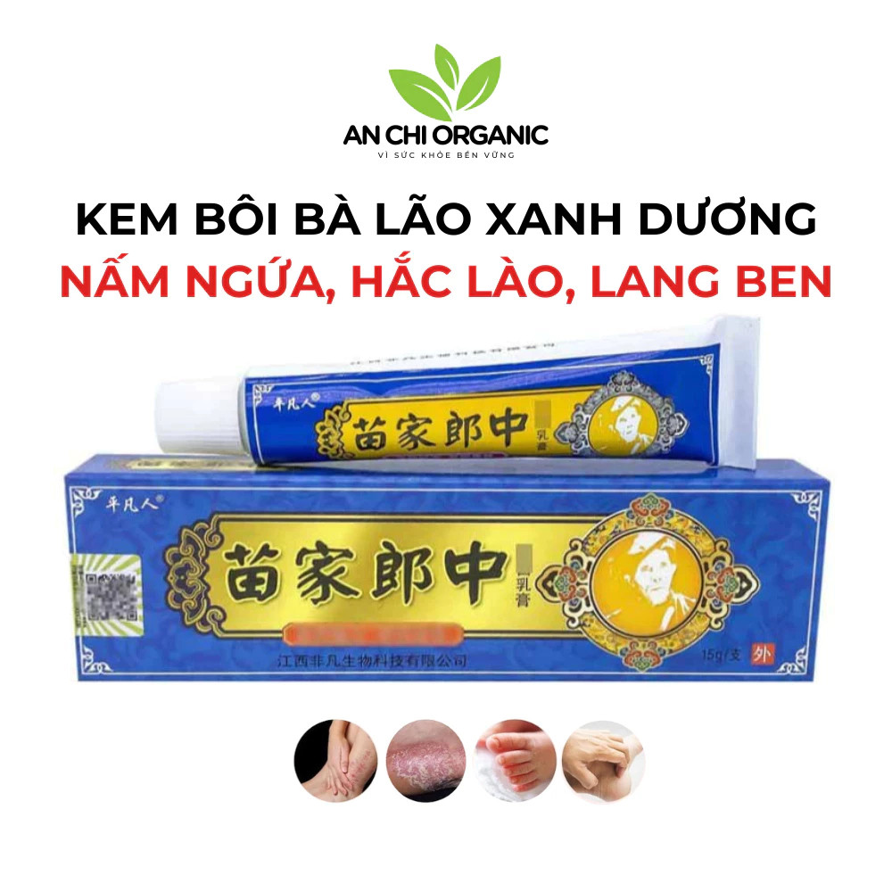 Kem Hỗ trợ giảm nấm ngứa, viêm da dị ứng, bệnh vẩy nến, keratosis pilaris, tinea versicolor - thảo mộc tự nhiên [kem xanh]