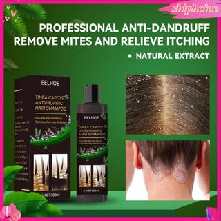 100Ml dầu gội tóc Bọt Giàu kiểm soát dầu Chăm Sóc Tóc Chống-Gàu Chống-Ngứa Dầu Gội Đầu Cho Nam Nữ