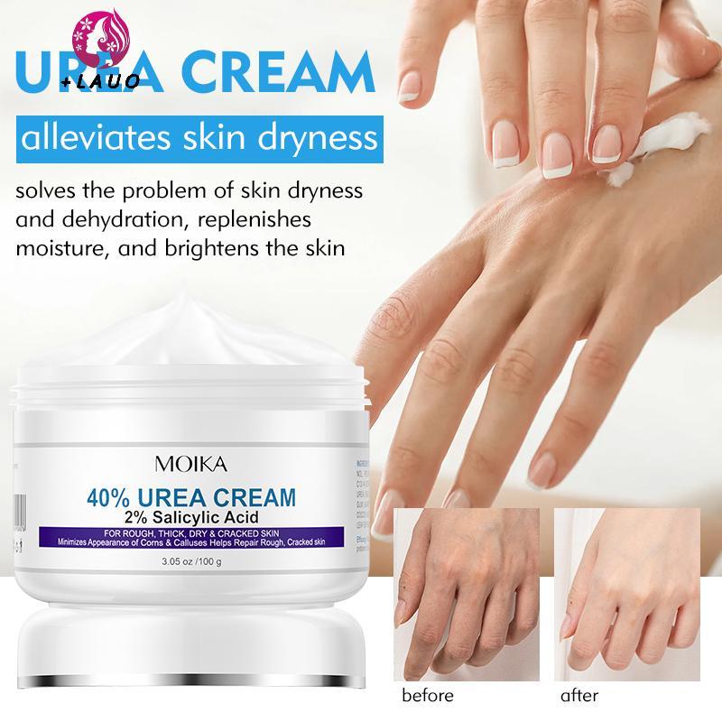 Springevenstar 40% Urea 2% Axit Salicylic Kem Dưỡng Ẩm Chăm Sóc Tay Kem Dưỡng Ẩm Chống Chèo Loại Bỏ Da Chết Chăm Sóc Da Springevenstar