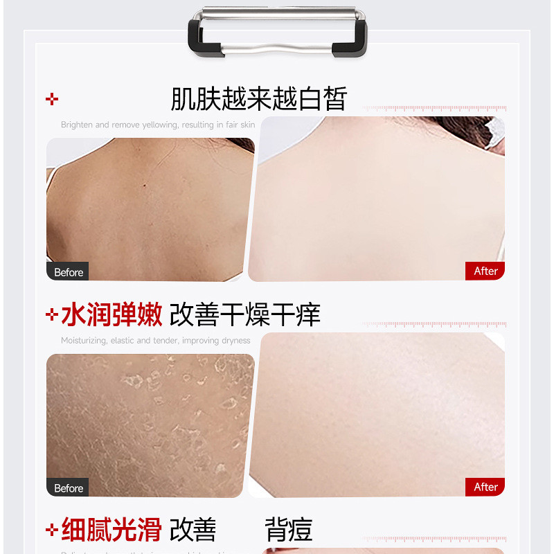 Sữa Tắm Dưỡng Ẩm Cải Thiện Bóng Tối Làm Sáng Màu Da Dưỡng Ẩm Cải Thiện Khô 377 Sữa Tắm 26.3.20